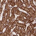 ATP5A1 Antibody in Immunohistochemistry (Paraffin) (IHC (P))