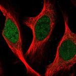 SGOL2 Antibody in Immunocytochemistry (ICC/IF)