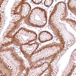 CHORDC1 Antibody in Immunohistochemistry (Paraffin) (IHC (P))