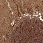 TRAP1 Antibody in Immunohistochemistry (Paraffin) (IHC (P))