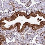 TRAP1 Antibody in Immunohistochemistry (Paraffin) (IHC (P))