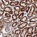 TRAP1 Antibody in Immunohistochemistry (Paraffin) (IHC (P))