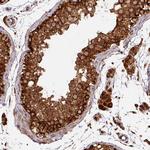 TRAP1 Antibody in Immunohistochemistry (Paraffin) (IHC (P))