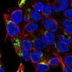 FAH Antibody in Immunocytochemistry (ICC/IF)