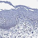 FAH Antibody in Immunohistochemistry (Paraffin) (IHC (P))