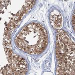 FAH Antibody in Immunohistochemistry (Paraffin) (IHC (P))