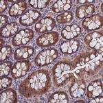 MVD Antibody in Immunohistochemistry (Paraffin) (IHC (P))