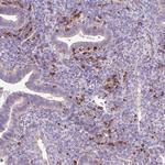 CD83 Antibody in Immunohistochemistry (Paraffin) (IHC (P))