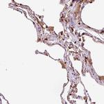 CD83 Antibody in Immunohistochemistry (Paraffin) (IHC (P))