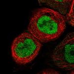 RNaseH2B Antibody in Immunocytochemistry (ICC/IF)