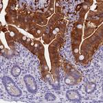 SULT2A1 Antibody in Immunohistochemistry (Paraffin) (IHC (P))