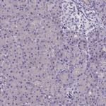 SULT2A1 Antibody in Immunohistochemistry (Paraffin) (IHC (P))