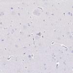 CD177 Antibody in Immunohistochemistry (Paraffin) (IHC (P))