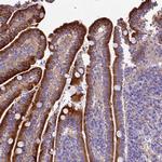 NOD2 Antibody in Immunohistochemistry (Paraffin) (IHC (P))