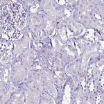 NOD2 Antibody in Immunohistochemistry (Paraffin) (IHC (P))