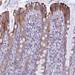 NOD2 Antibody in Immunohistochemistry (Paraffin) (IHC (P))