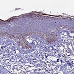 NOD2 Antibody in Immunohistochemistry (Paraffin) (IHC (P))