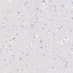 EHHADH Antibody in Immunohistochemistry (Paraffin) (IHC (P))