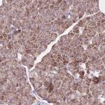 NDUFA9 Antibody in Immunohistochemistry (Paraffin) (IHC (P))