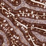 NDUFA9 Antibody in Immunohistochemistry (Paraffin) (IHC (P))