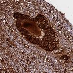 WFDC2 Antibody in Immunohistochemistry (Paraffin) (IHC (P))