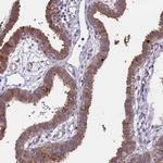 WFDC2 Antibody in Immunohistochemistry (Paraffin) (IHC (P))