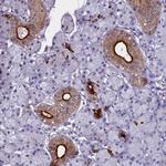 WFDC2 Antibody in Immunohistochemistry (Paraffin) (IHC (P))