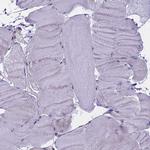 WFDC2 Antibody in Immunohistochemistry (Paraffin) (IHC (P))