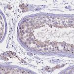 WFDC2 Antibody in Immunohistochemistry (Paraffin) (IHC (P))