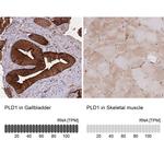 PLD1 Antibody