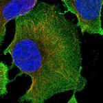 PLD1 Antibody in Immunocytochemistry (ICC/IF)