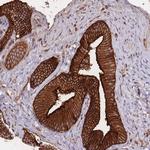 PLD1 Antibody in Immunohistochemistry (Paraffin) (IHC (P))