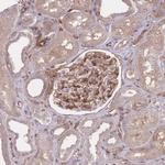 PLD1 Antibody in Immunohistochemistry (Paraffin) (IHC (P))