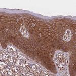 PLD1 Antibody in Immunohistochemistry (Paraffin) (IHC (P))