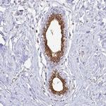 Calmyrin Antibody in Immunohistochemistry (Paraffin) (IHC (P))