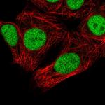 SNRPC Antibody in Immunocytochemistry (ICC/IF)