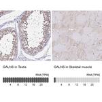 GALNS Antibody