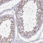 GALNS Antibody in Immunohistochemistry (Paraffin) (IHC (P))