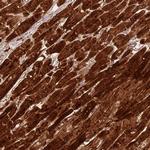 CSRP3 Antibody in Immunohistochemistry (Paraffin) (IHC (P))