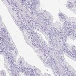 CSRP3 Antibody in Immunohistochemistry (Paraffin) (IHC (P))