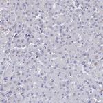 BRD2 Antibody in Immunohistochemistry (Paraffin) (IHC (P))