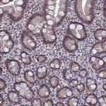 BRD2 Antibody in Immunohistochemistry (Paraffin) (IHC (P))