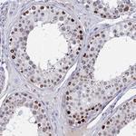 BRD2 Antibody in Immunohistochemistry (Paraffin) (IHC (P))