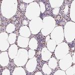 PADI4 Antibody in Immunohistochemistry (Paraffin) (IHC (P))