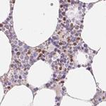 PADI4 Antibody in Immunohistochemistry (Paraffin) (IHC (P))