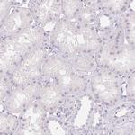 PADI4 Antibody in Immunohistochemistry (Paraffin) (IHC (P))