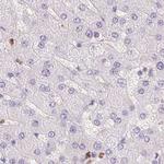 PADI4 Antibody in Immunohistochemistry (Paraffin) (IHC (P))