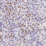 PADI4 Antibody in Immunohistochemistry (Paraffin) (IHC (P))