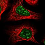 COPS4 Antibody in Immunocytochemistry (ICC/IF)