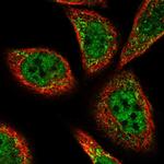 PEX3 Antibody in Immunocytochemistry (ICC/IF)